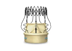 Suture less valve